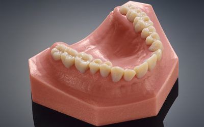 Need a 3D printed Tooth?