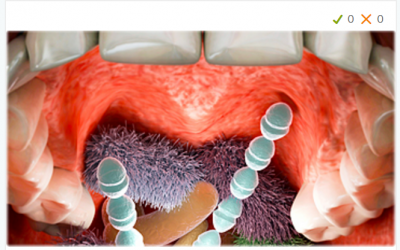 What Germs Live in You Mouth? Quiz