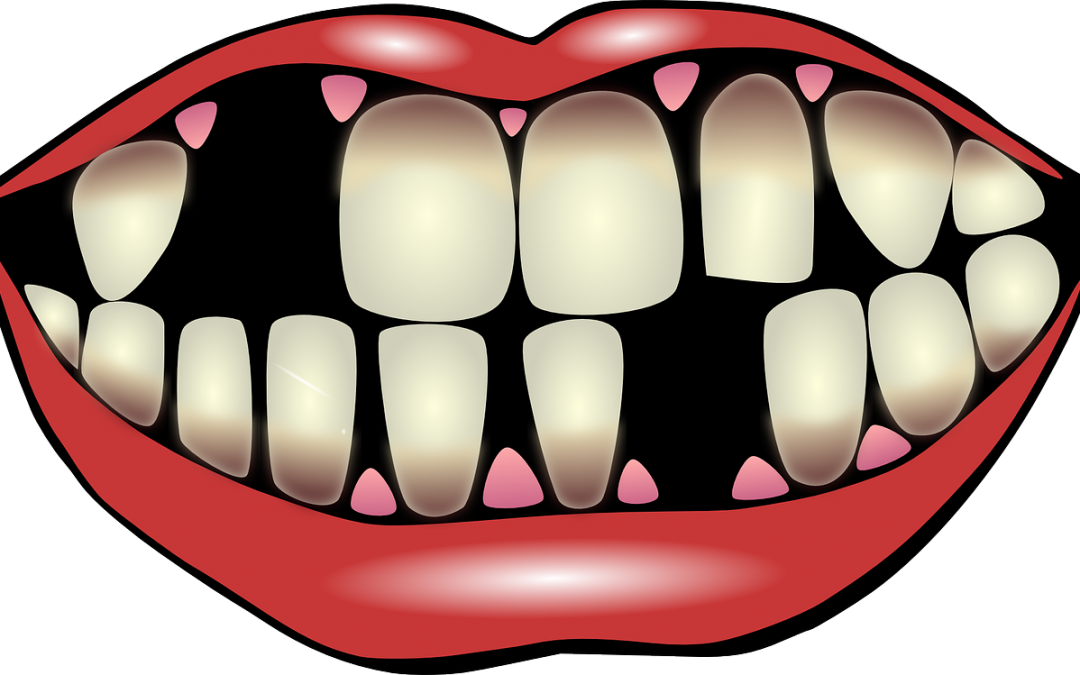 9 Factors For Losing Your Teeth