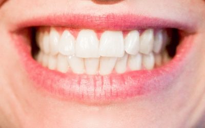 Do At Home Teeth Whiteners Really Work?