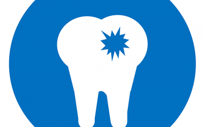 How Does A Cavity Form?