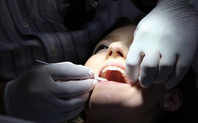 7 Reasons You Need to Visit Your Dentist Regularly