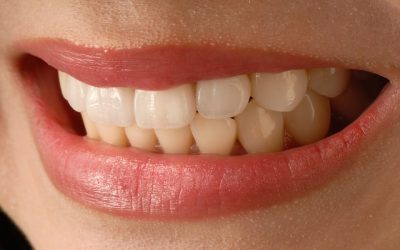 7 Ways to Care for Sensitive Teeth